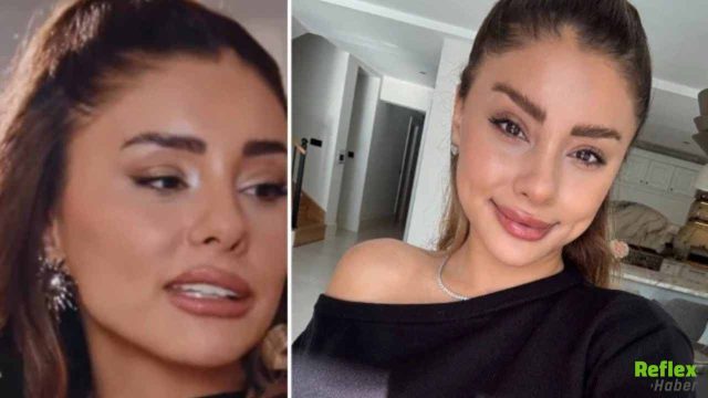 Samar Dadgar Kimdir, Estetik Yaptırdı Mı?