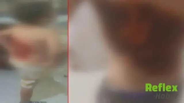 Arnavutköy’de 12 Yaşındaki Batuhan Kolonya Saldırısında Yaralandı