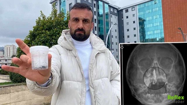 5 Yaşındaki Polen’in Burnundan 2 Yıllık Zincir Çıktı İhmal İddiası Gündemde