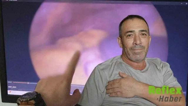 Muzaffer Uzunbacak Organlarının Ters Yerleşimli Olduğunu 54 Yaşında Öğrendi