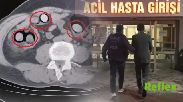 Tatvan’da Yolcunun Mide Ve Bağırsaklarından 758 Gram Metamfetamin Çıktı