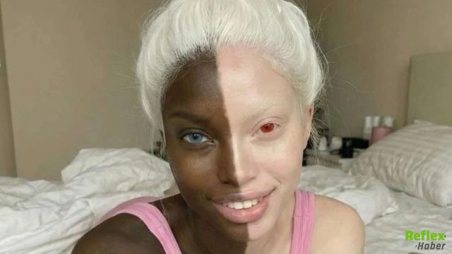 Eva Delonne Gerçek Mi? Rengi Makyaj Mı?