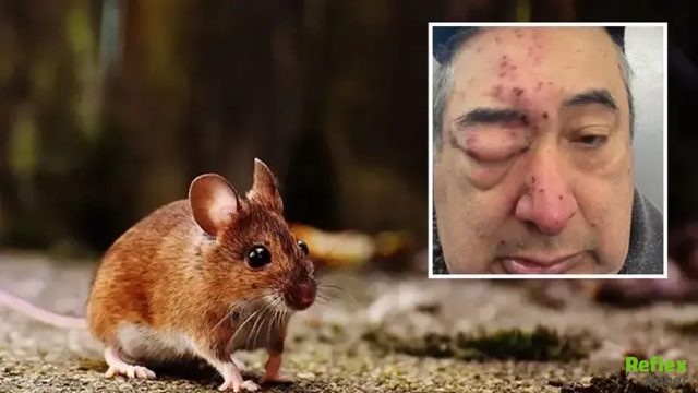 Evinde Uyurken Farelerin Saldırısına Uğradı! Yüzü Tanınmaz Hale Geldi