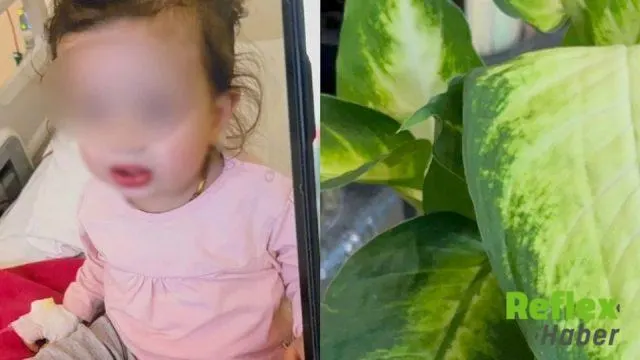 Tokat'ta Difenbahya Yiyen Çocuk Yoğun Bakımda Tedavi Edildi