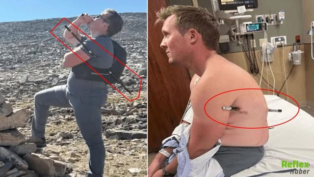 Gövdesini Delen Trekking Sopasıyla 16 Kilometre Yürüdü: Hayata Tutundu
