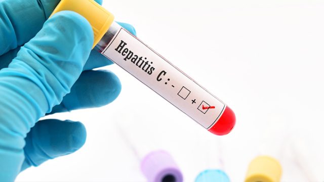 Hepatit C, sinsi bir hastalık olduğu için ileri evrede belirti gösteriyor