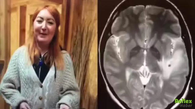 Hindistan Seyahati Hayatını Değiştirdi! Beyninde 38 Parazit Tespit Edildi