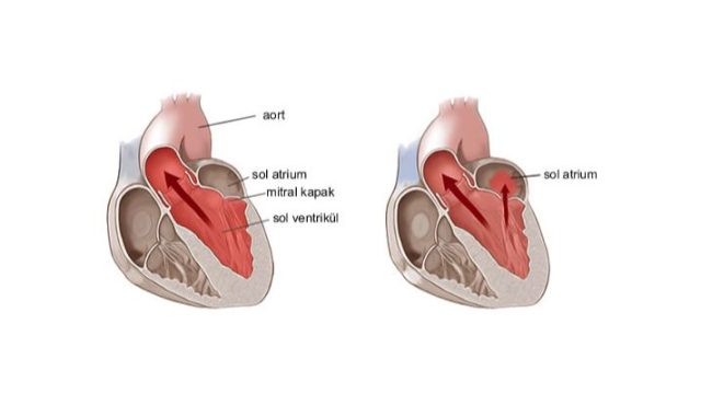 Kalbin içindeki mucize: Mitral kapak