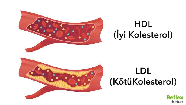 Kolesterol Neden Yükselir İşte En Yaygın Nedenler