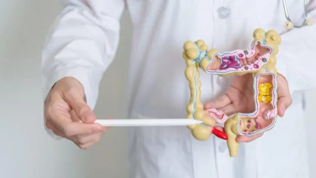 Kolon Kanseri Kimlerde Daha Sık Görülür? İşte Risk Faktörleri