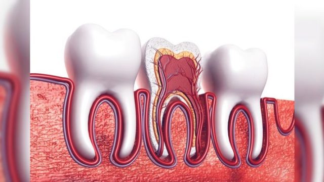 Kulağa vuran diş ağrısı pulpitis kaynaklı olabilir mi, kanal tedavisi nedir?