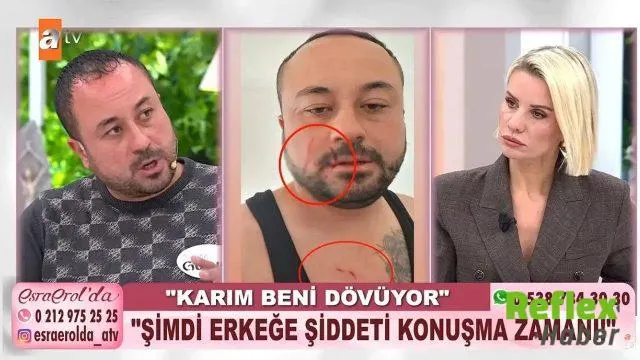 Gökhan Madenci, Esra Erol’da Eşiyle Yaşadığı Şiddet İ̇ddialarını Anlattı