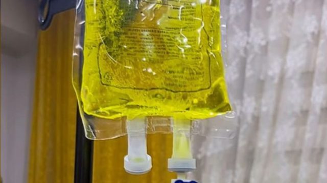Sarı serum nedir? Riskleri nelerdir?