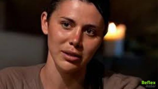 Survivor Nefise Karatay’ın Bıyıkları mı Var? Dudağının Üstü Neden Siyah?