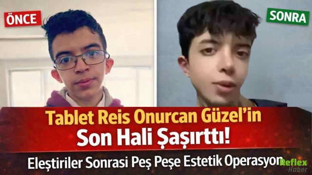 Tablet Reis Onurcan Güzel’in Son Hali Şaşırttı! Eleştiriler Sonrası Peş Peşe Estetik Operasyon