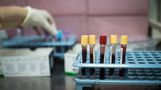 Türkiye'nin kanser haritası çıkarıldı: İstanbul ilk 10'da, zirvede Ağrı var