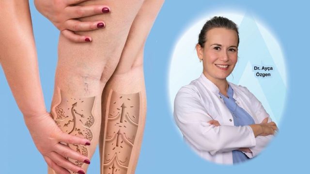 Varise karşı ne yapmalı? 8 etkili yöntem