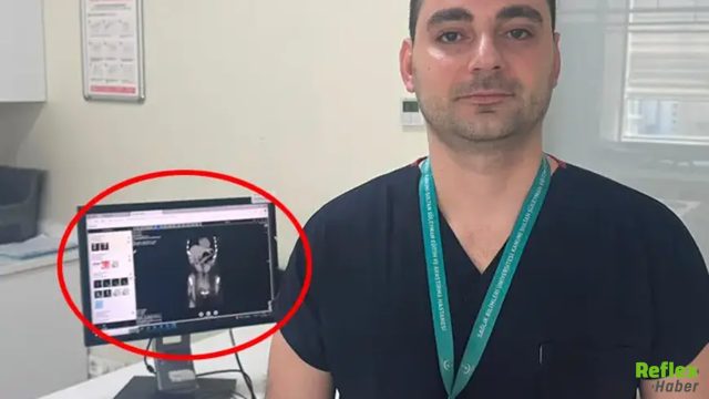 Zayıflamak İçin Yaptığı Şey Hayatını Kabusa Çevirdi! Midesinden Diş Fırçası Çıktı