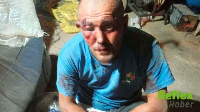 Ceyhan’da Selçuk Demir’e Çocuğun Başını Okşadığı İ̇ddiasıyla Darp